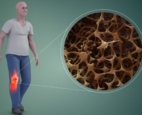 Krill et osteoporose