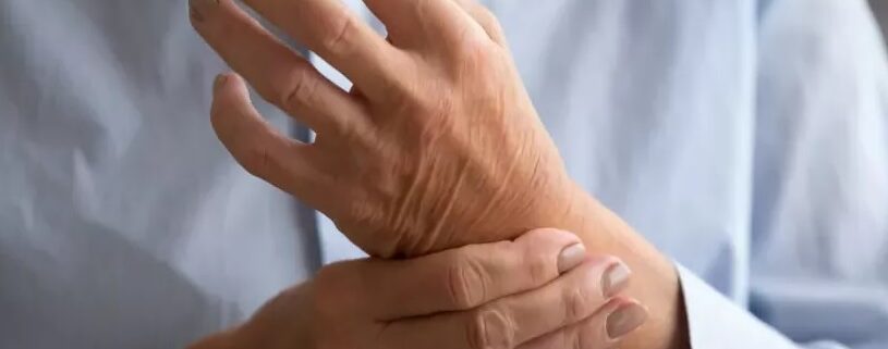 poly arthrite rhumatoide